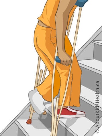 Climbing stairs using two crutches