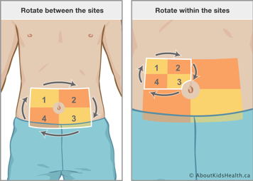 Rotating clockwise between four sites on the lower abdomen, and rotating clockwise within each of those sites