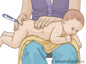 Baby lying on tummy across a lap with thermometer inserted in the baby’s rectum