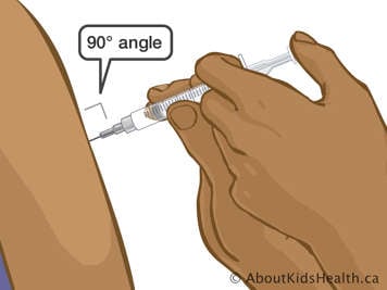 Placing finger on plunger of needle inserted at a ninety-degree angle