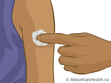 Holding cotton ball to upper arm