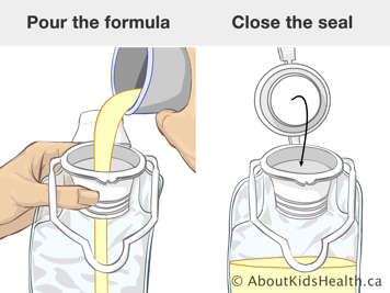 Pouring formula into feeding bag and closing the seal on the feeding bag