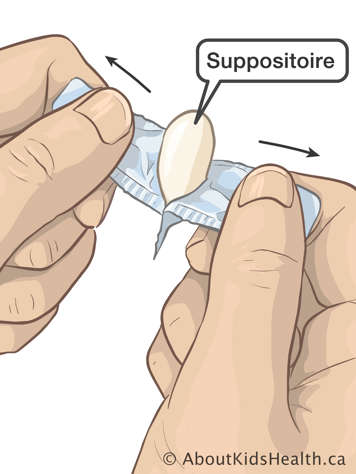 L’ouverture de l'emballage du suppositoire