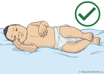 Baby laying on their side with sternal incision, which is a recommended position