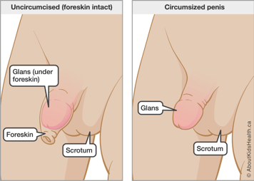 Identification of glands, foreskin and scrotum of an uncircumcised penis, and the glands and scrotum of a circumcised penis