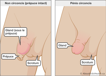 Identification du gland, du prépuce et du scrotum d'un pénis non circoncis et du gland et du scrotum d'un pénis circoncis