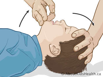 Opening child's airway for rescue breaths