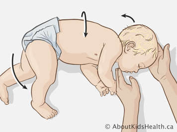 Situando al bebé en la postura de recuperación (posición lateral de seguridad)