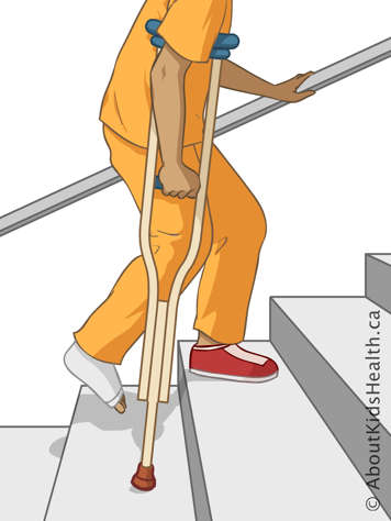 Using one crutch and a handrail to climb stairs