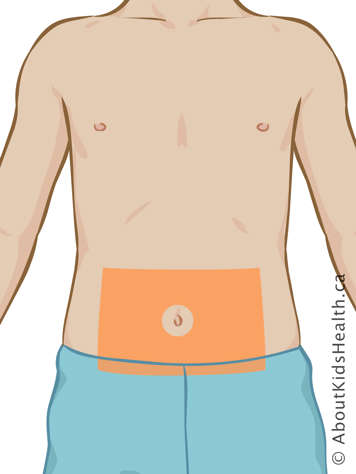 Site d’injection d’isuline sur le bas de l’abdomen