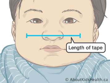 Length of tape across baby’s nose and cheeks