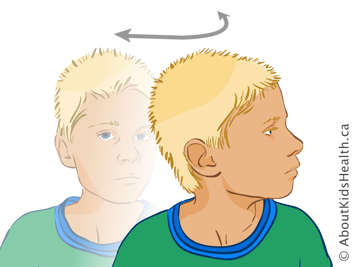 Boy with head turned to one side so that his chin is pointed toward his shoulder