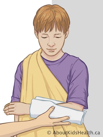 Wrapping towel around child's injured arm, keeping the arm held over triangular bandage