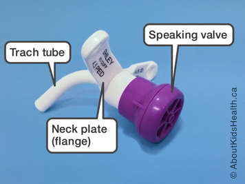 Identification of speaking valve, neck plate and trach tube