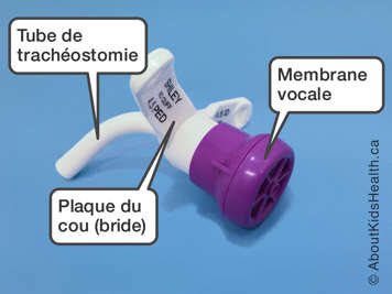 Identification du tube de trachéostomie, de la plaque du cou et de la membrane vocale