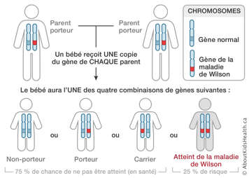 Distribution des chromosomes des parents porteurs de la maladie Wilson