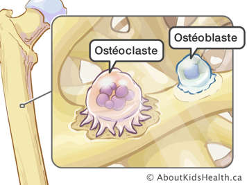 Illustration d’un ostéoclaste et d’un ostéoblaste dans un os