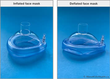 Inflated face mask and a deflated face mask