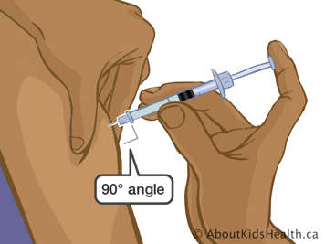 Placing finger on plunger of needle inserted into upper arm at a ninety-degree angle