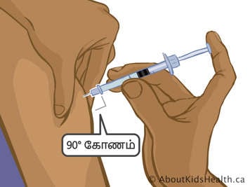 தொண்ணூறு டிகிரி கோணத்தில் செருகப்பட்ட ஊசியின் உலக்கையில் விரலை வைப்பது