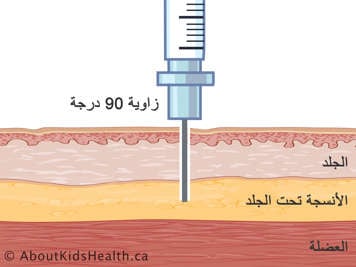 مقطع عرضي للجلد والأنسجة تحت الجلد والعضلات بإبرة محقونة بزاوية تسعين درجة