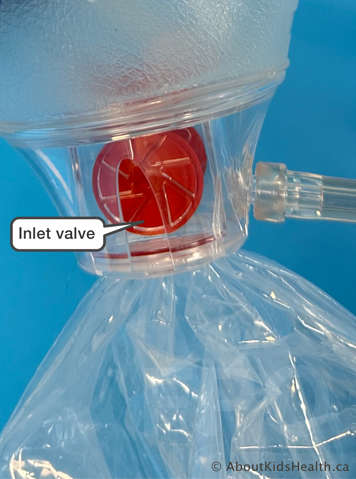 Inlet valve on a manual resuscitation bag