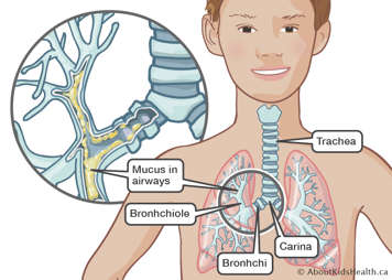 Anatomy of the airways including the trachea, carina, bronchi and bronchioles