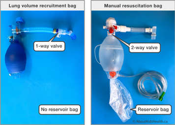A lung volume recruitment bag showing a one-way valve and no reservoir bag compared to a manual resuscitation bag showing a two-way valve and a reservoir bag