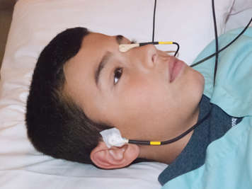Child with electrodes attached to nose and in front of ears