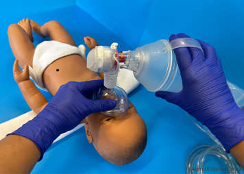 Manual resuscitation bag and facemask on a baby