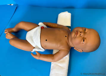 Child without a tracheostomy tube being positioned by placing a rolled up towel under their shoulders