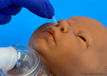 Inserting a suction catheter into a nostril