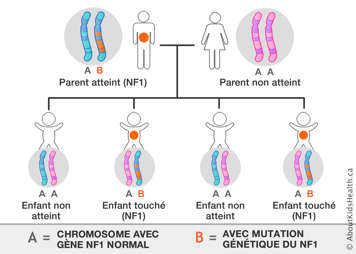 Distribution des chromosomes d’un parent portant un chromosome avec mutation génétique du NF1 et d'un parent non atteint