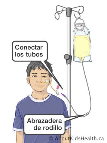 Connect tubes and roller clamp on infusion tubing for attaching a feeding bag to a child&rsquo;s NG tube