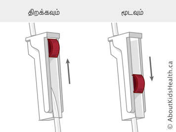 An open clamp and a closed clamp on infusion tubing