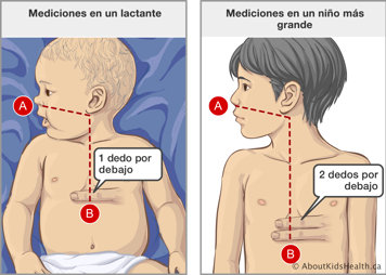 Mediciones en un bebé y en un niño mayor y localización de la base del esternón y del ombligo en ambos