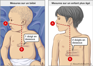 Mesures sur un bébé et sur un enfant plus âgé, avec un doigt sur le bébé et deux doigt sur l’enfant en-dessous du sternum