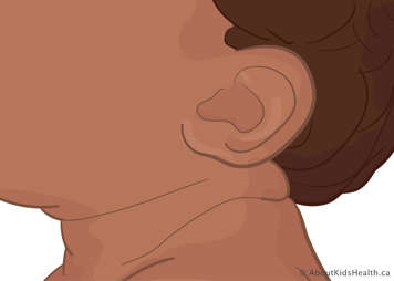 Ears that are oval-shaped and sit lower on the head