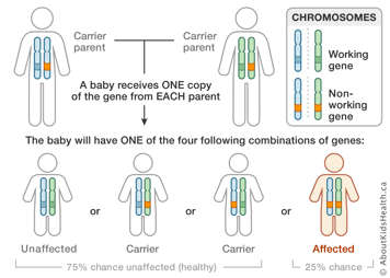 Inheritance chart showing 4 possible gene combinations from 2 carrier parents: 1. unaffected, 2 and 3. carrier, 4. affected