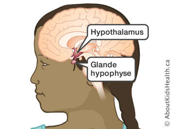 Localisation de l'hypothalamus et de l'hypophyse