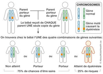 Les combinaisons de chromosomes possibles de deux parents porteurs de dyskinésie