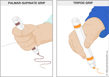 Illustration of palmar-supinate grip and tripod grip on a marker