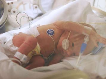Mildly premature baby lying in isolette