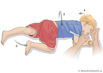 Enfant étendu sur son côté avec une jambe pliée par le genou vers son visage et un soignant tenant la tête vers l’arrière