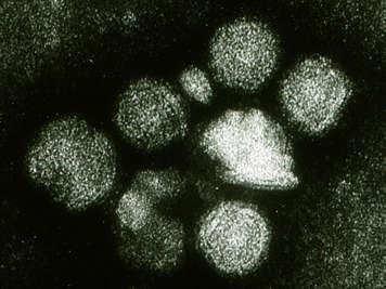 Microscopic view of rubella virus