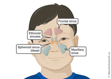 Location of the frontal sinus, maxillary sinus, sphenoid sinus (deep) and ethmoid sinuses