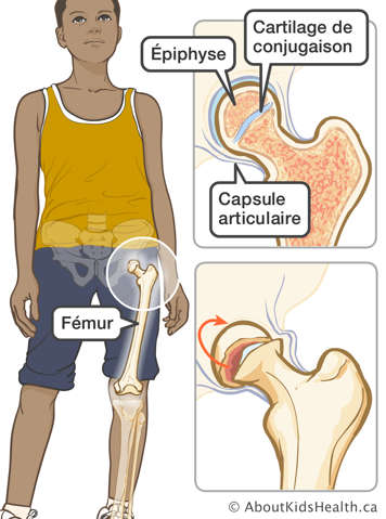 L’emplacement de la capsule articulaire et de l’épiphyse et cartilage de conjugaison séparés dans le fémur