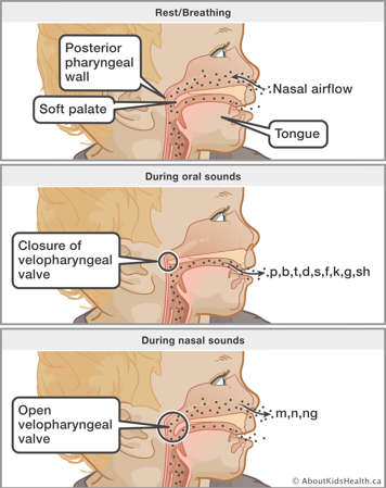 How the soft palate works during speech