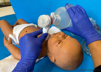 Manual resuscitation bag and stoma mask on a baby