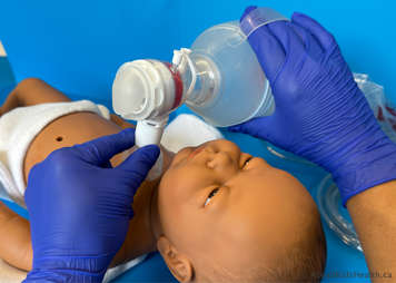 Stoma mask that is attached to the manual resuscitation bag being placed over the stoma